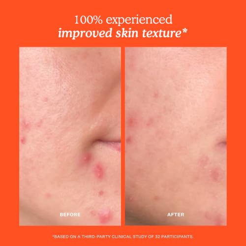 SOS Recovery Hydrating Face Cream