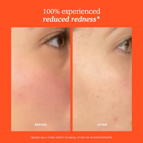 SOS Recovery Hydrating Face Cream