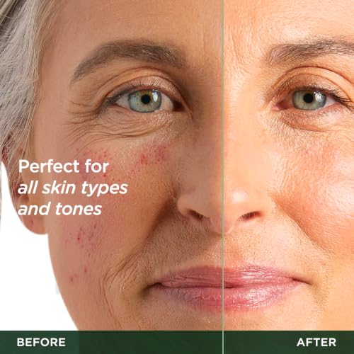 Vitamin C Serum for Face