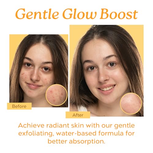 10% mandelic serum lactic glycolic