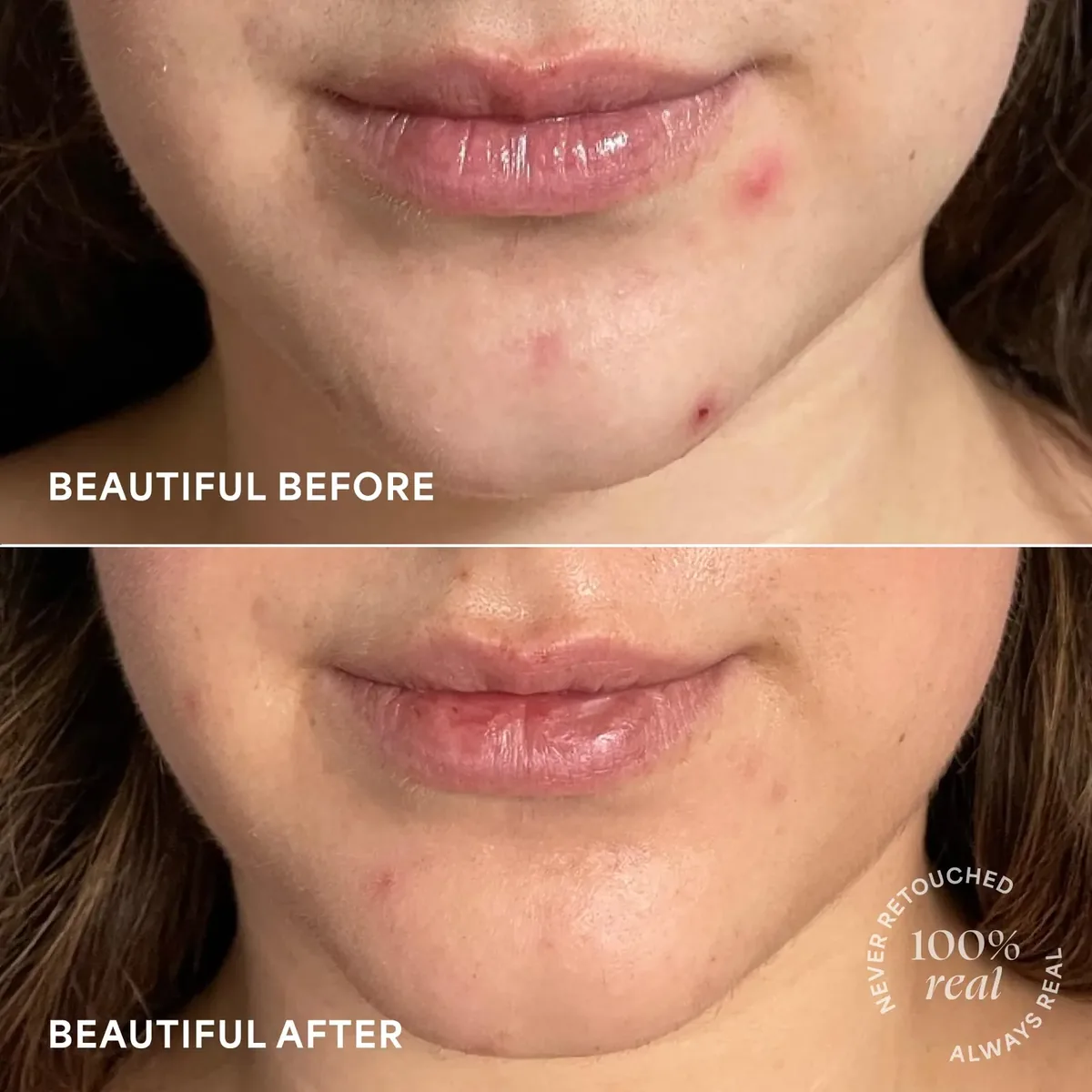Brightening Treatment Drops