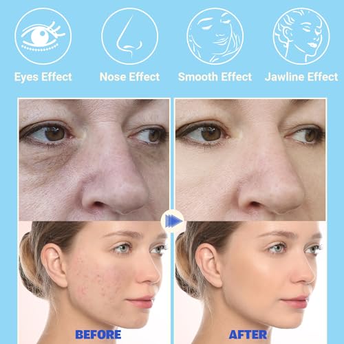 Blue High Frequency Facial Wand Device