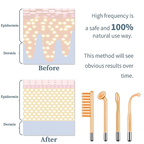 High Frequency Facial Machine Portable Handheld