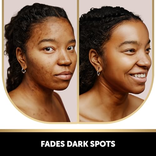 Kojic Acid Soap for Hyperpigmentation - with Glutathione, Collagen & Vitamin C - Advanced Soap Bars with Turmeric - Original Japanese Complex for Dark Spot Correction - 2 P
