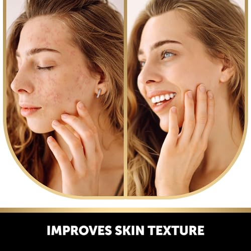 Kojic Acid Soap for Hyperpigmentation - with Glutathione, Collagen & Vitamin C - Advanced Soap Bars with Turmeric - Original Japanese Complex for Dark Spot Correction - 2 P