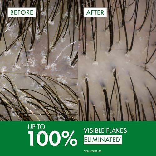 Dercos Dandruff Shampoo, Antifungal Itchy Scalp Treatment