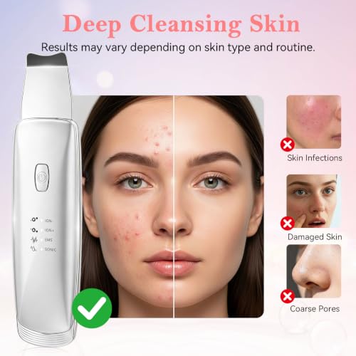4 in 1 Skin Scrubber Face Spatula Pore Cleaner