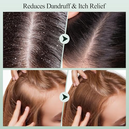 Scalp Scrub, Rosemary Scalp Exfoliator Scrub Shampoo