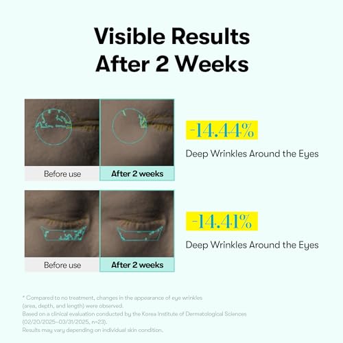 PDRN Reedle Shot Eye Cream