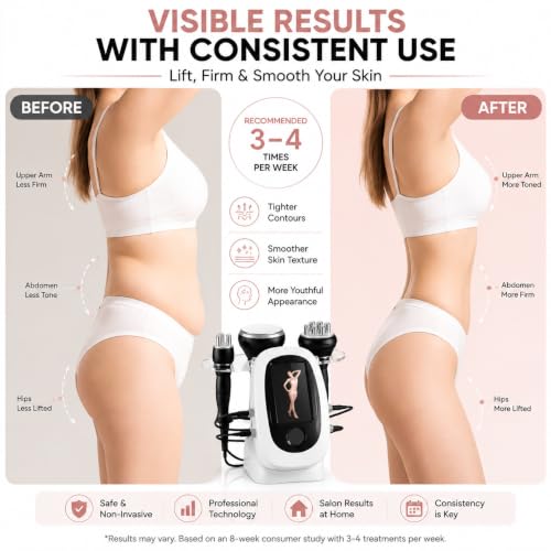 Radio Frequency Skin Care Device for Wrinkle Reduction