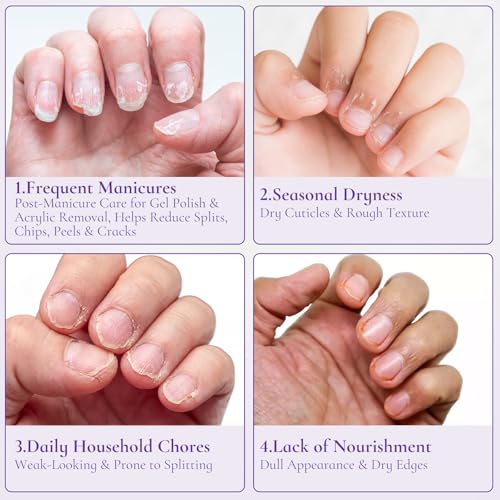 Cuticle Cream for Nails, Moisturizer for Dry Cracked Cuticles, 15ml