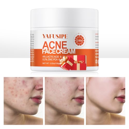 Face Cream for Acne-Prone Skin Women Teens Adults Men Body Back 1.1