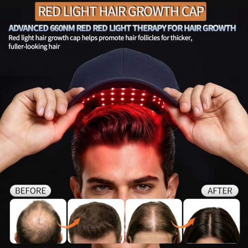 LLLT Red Light Hair Growth Cap