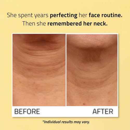 Neck Firming Cream with Vitamin C