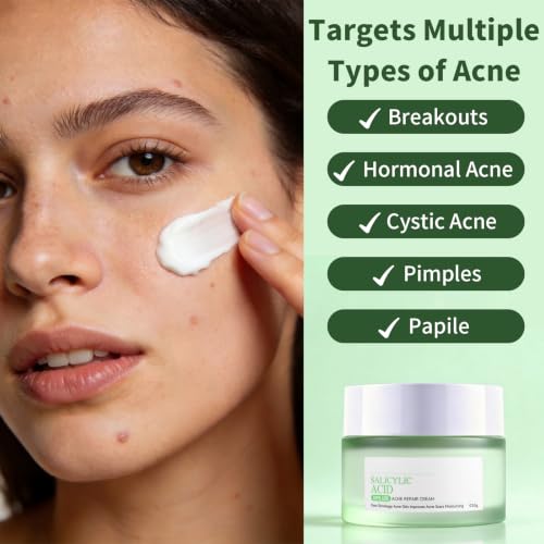 Acne Treatment for Face Hormonal Cystic Acne Treatment Cream Salicylic Acid Acne Cream for